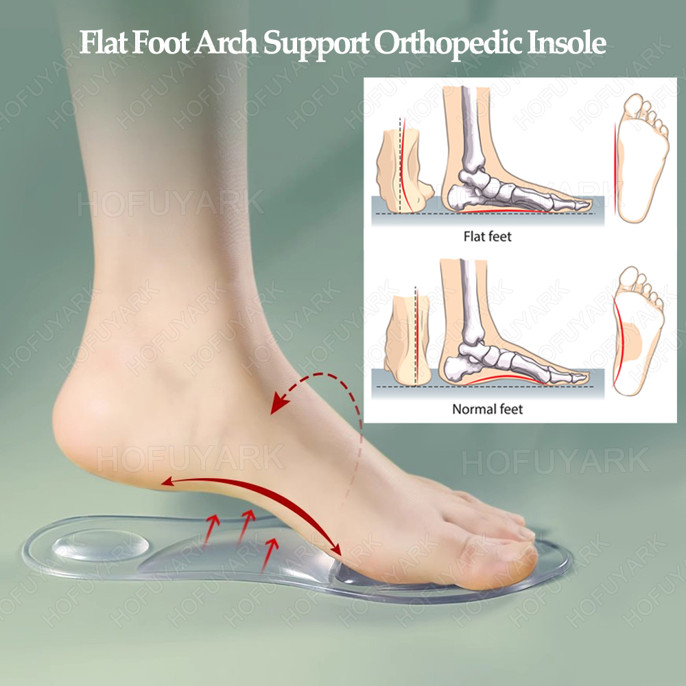 シリコーンゲルインソール整形外科扁平足アーチサポート足底筋膜 - Women'S Shoes Plantar Fasciitis のレビューと価格